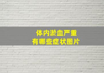 体内淤血严重有哪些症状图片