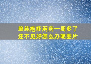 单纯疱疹用药一周多了还不见好怎么办呢图片