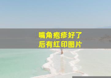 嘴角疱疹好了后有红印图片