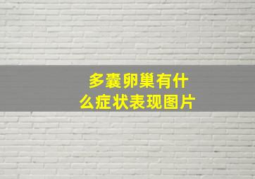 多囊卵巢有什么症状表现图片