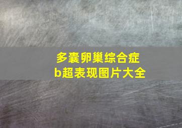 多囊卵巢综合症b超表现图片大全