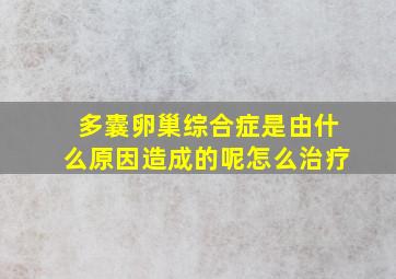 多囊卵巢综合症是由什么原因造成的呢怎么治疗