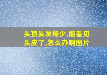 头顶头发稀少,能看见头皮了,怎么办啊图片