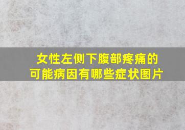 女性左侧下腹部疼痛的可能病因有哪些症状图片