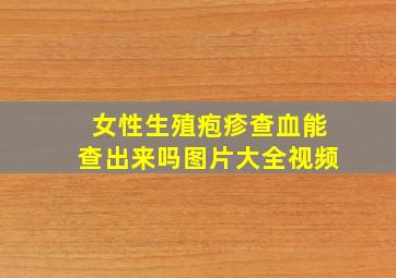 女性生殖疱疹查血能查出来吗图片大全视频