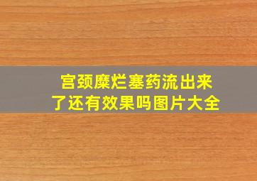 宫颈糜烂塞药流出来了还有效果吗图片大全