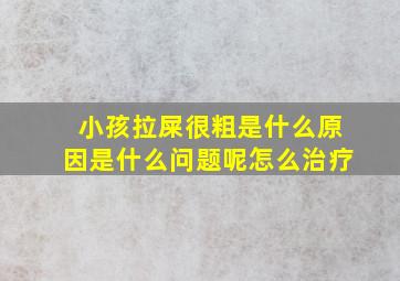 小孩拉屎很粗是什么原因是什么问题呢怎么治疗