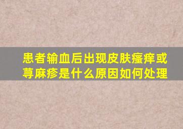 患者输血后出现皮肤瘙痒或荨麻疹是什么原因如何处理