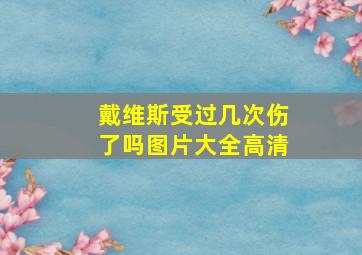 戴维斯受过几次伤了吗图片大全高清