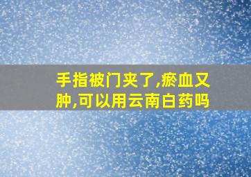 手指被门夹了,瘀血又肿,可以用云南白药吗