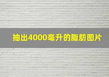 抽出4000毫升的脂肪图片