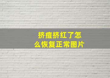 挤痘挤红了怎么恢复正常图片