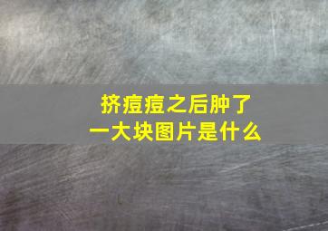 挤痘痘之后肿了一大块图片是什么