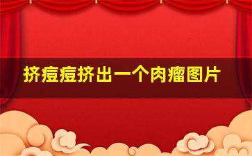 挤痘痘挤出一个肉瘤图片