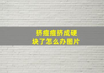 挤痘痘挤成硬块了怎么办图片