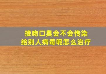 接吻口臭会不会传染给别人病毒呢怎么治疗