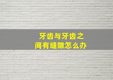 牙齿与牙齿之间有缝隙怎么办