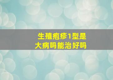 生殖疱疹1型是大病吗能治好吗