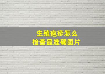 生殖疱疹怎么检查最准确图片