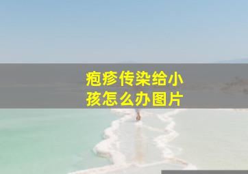 疱疹传染给小孩怎么办图片