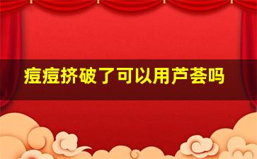 痘痘挤破了可以用芦荟吗