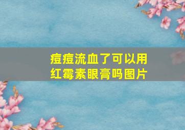 痘痘流血了可以用红霉素眼膏吗图片