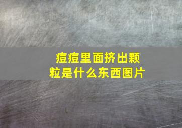 痘痘里面挤出颗粒是什么东西图片