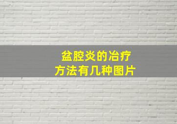 盆腔炎的冶疗方法有几种图片