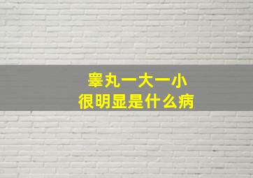 睾丸一大一小很明显是什么病