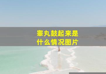 睾丸鼓起来是什么情况图片