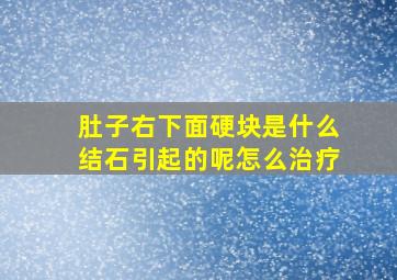 肚子右下面硬块是什么结石引起的呢怎么治疗