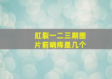 肛裂一二三期图片前哨痔是几个