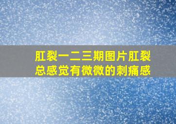 肛裂一二三期图片肛裂总感觉有微微的刺痛感