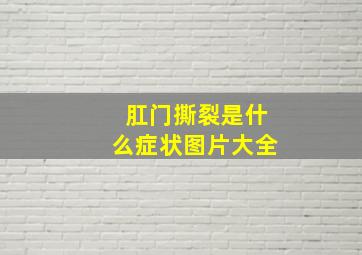 肛门撕裂是什么症状图片大全