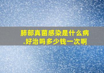 肺部真菌感染是什么病.好治吗多少钱一次啊