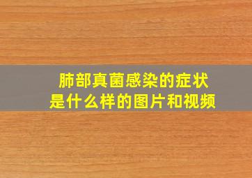 肺部真菌感染的症状是什么样的图片和视频