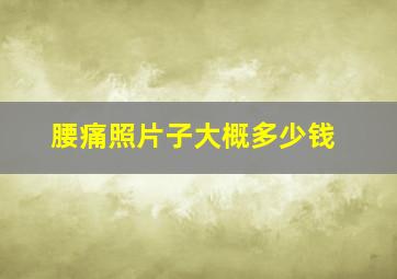 腰痛照片子大概多少钱