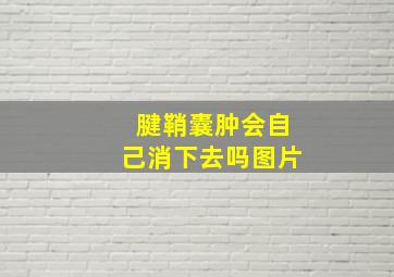 腱鞘囊肿会自己消下去吗图片