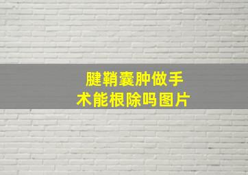 腱鞘囊肿做手术能根除吗图片