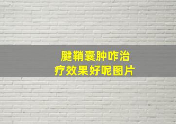 腱鞘囊肿咋治疗效果好呢图片