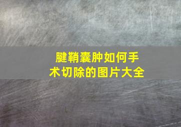 腱鞘囊肿如何手术切除的图片大全