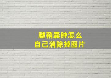 腱鞘囊肿怎么自己消除掉图片