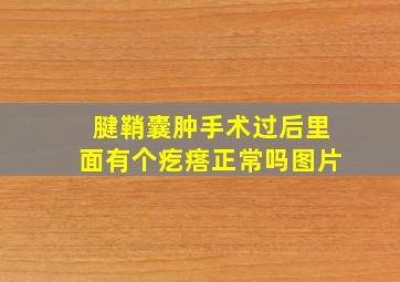 腱鞘囊肿手术过后里面有个疙瘩正常吗图片