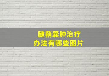 腱鞘囊肿治疗办法有哪些图片