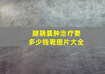 腱鞘囊肿治疗要多少钱呢图片大全