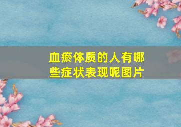 血瘀体质的人有哪些症状表现呢图片