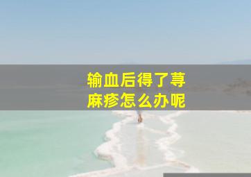 输血后得了荨麻疹怎么办呢