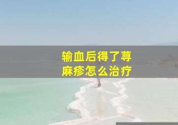 输血后得了荨麻疹怎么治疗