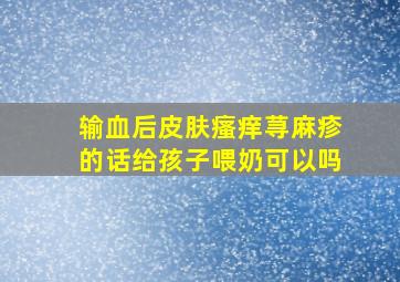 输血后皮肤瘙痒荨麻疹的话给孩子喂奶可以吗