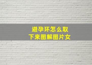 避孕环怎么取下来图解图片女